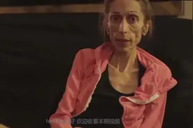 美女极端减肥患上厌食症，模样吓人，来中国后不治而愈！视频封面