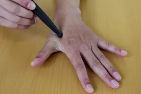 便秘口臭，该清清大肠湿热了，每天1穴，泻肠火清湿热，大肠健康