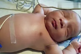 今天接生了一个胖胖的新生儿，无意间拍下新生儿标准的腹式呼吸法