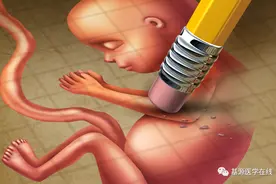 大众普遍采用的这几种避孕法，失败率或可超过40%图片