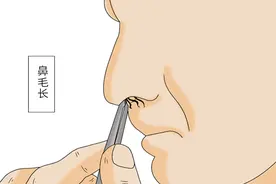 鼻毛“窜”出鼻孔说明什么？该剪还是该拔？建议您看完再决定图片