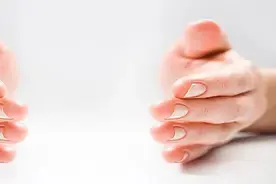 对付手脚脱皮，看看那个方子适合你图片