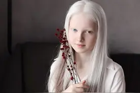 少女身患白化病和异色瞳，美得让人心疼！一眼冰雪，一眼森林…只有1亿分之1概率出生图片
