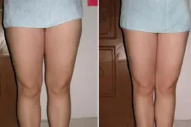 出现大象腿的2个原因！6个腿部动作，让你轻松告别大象腿图片