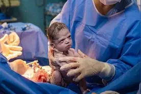 出生不哭还怒视医生，宝宝出生就引发热议，网友：行走的表情包图片