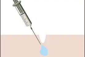 玻尿酸溶解视频图片