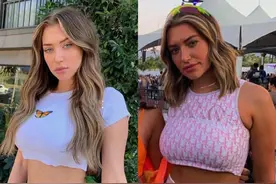 超模腿上满是橘皮，卡戴珊式腰臀比全靠P图，她们都没有那么完美图片