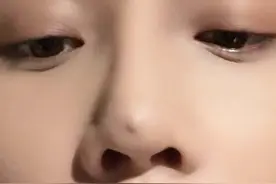 刘雨昕遮痘磨皮，尹净汉用痘痘贴，对抗粉刺你还需要这些图片