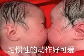 龙凤胎出生20分钟，哥哥妹妹“亲成一团”，护士直呼：太有爱了图片
