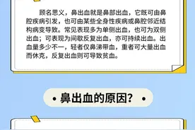 鼻出血该怎么办？仰头、高抬手……这些方法都不对图片