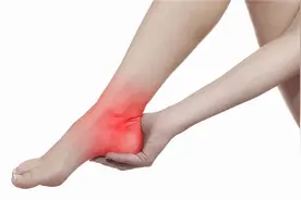 足跟疼？大概是足底筋膜炎盯上你了！——腹针治疗足底筋膜炎病例分享图片