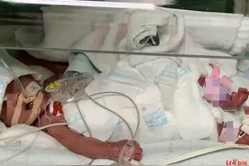 揪心！早产双胞胎姐妹出生仅2斤，父母这句话让人泪目图片