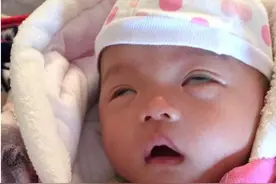 宝宝睡觉翻白眼怎么回事？原来是因为这个原因图片