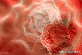 肺癌根本不用治，治好的都是误诊了？肿瘤院长讲了两个真相图片