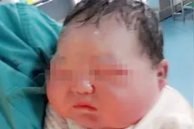 宝宝出生5天还不睁眼，医生说出治疗方案，妈妈跪求医生放弃治疗