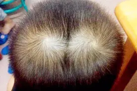 原来孩子头上的旋，可以看出孩子出生的时辰！来看看你家的准不准视频封面