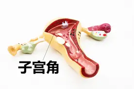 出现宫角孕怎么办？听听医生是怎么说的吧