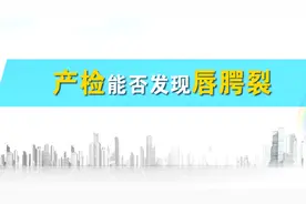 产检一定能查出唇腭裂畸形吗？听听专业医生的回答