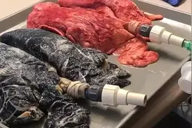 吓人！她用20年老烟民的肺与健康的肺做了个实验 警醒无数人