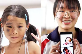 汶川地震伤后打“胜利”手势的小女孩：我已长大，未来我要当医生视频封面