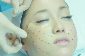 日本女星用“婴儿皮肤”做整容，整个人都毁掉了！视频封面