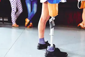 病人截肢后的断肢医院是怎么处理的？今天可算知道了