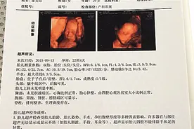 四维彩超单上的3个数据，告诉你胎儿发育好不好！自己检查一下！视频封面