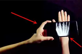 新发现一黑科技！手机就能拍出x光片！真神奇！后悔没早点知道！视频封面