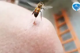 国外拿蜜蜂尾部的刺儿来治疗风湿，就这样扎下去！不疼吗？