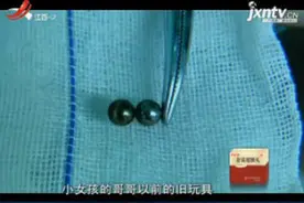 广东惠州：5岁女童误吞强磁钢珠致肠穿孔视频封面