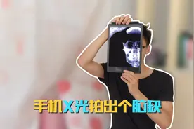 苹果手机拍出X光照片！学会这一招，才发现自己是颜值爆表的脑缺视频封面