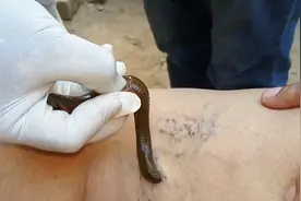 农村常见的“吸血鬼”，不仅是一味中药，还能吸血治病！