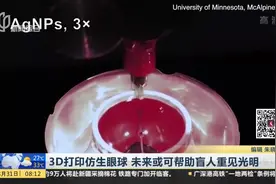 重大突破！科学家3D打印仿生眼球 未来有望用于盲人复明视频封面