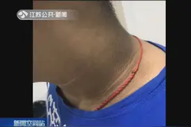 11岁男孩狂喝碳酸饮料，皮肤突然“变黑”，医院一查大吃一惊！