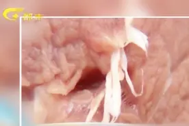 猪肉里拽出“白虫”到底是何物？专业人士为你揭开谜底！视频封面