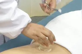 多刺激这一穴位能补肾 真人演示拔罐、艾灸、按摩等多种操作方法