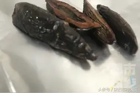 西安一男子突然张不开嘴 竟和嚼食槟榔有关……图片