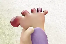 熊出没：光头强的脚冻伤了，红肿发痒受不了了