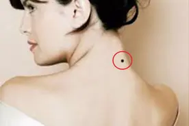 为什么那么多人的脖子后面总会出现一颗黑痣？视频封面