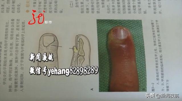 瓶身有花的甲油胶 2026年瓶身有花的甲油胶有毒吗