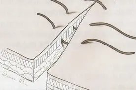 手术拆线后伤口如何护理？这几点一定要记住图片