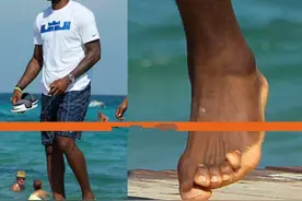 年赚千万的NBA球星多不容易？詹姆斯脚趾变形，罗斯伤疤令人心疼图片