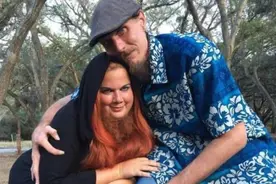 先天畸形的“龙虾男孩”，本该拥有幸福人生，却因嫉妒终成恶魔图片