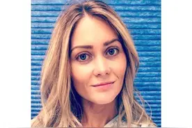 外国女孩以黑为美，狂晒日光浴致皮肤癌、面部凹坑毁容图片