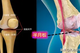 为什么膝关节疼痛肿胀伴活动受限与半月板有关，孔医生详细告诉您图片