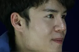 男生磨骨术后2周记录，室友都夸太帅，这个过程痛也值得图片