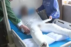 长沙25岁男子掉入化工池致重度烧伤，涉事公司：你马路上摔跤找修路的？图片