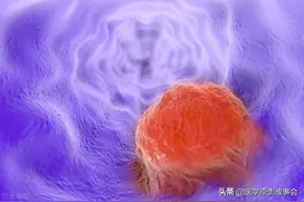 这三个部位发现息肉，最好及时切除，时间久了容易发生恶变图片