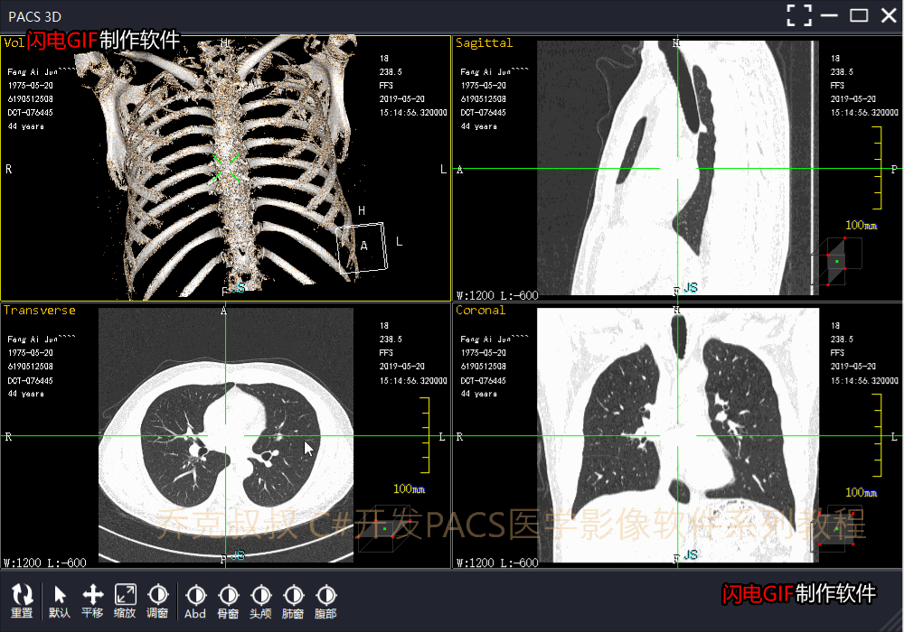 C#开发PACS医学影像三维重建(一)使用VTK重建3D影像图片