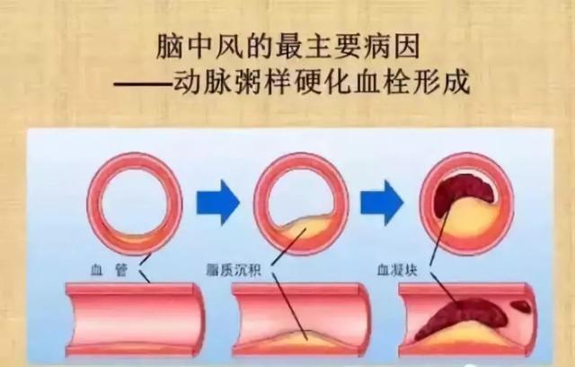 小分子活性肽对心脏的作用 2026年最新小分子活性肽对心脏的作用